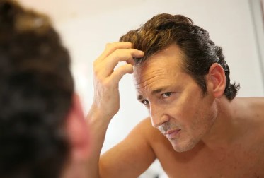 Male Hair Loss Remedies