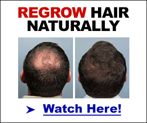best cure hair loss